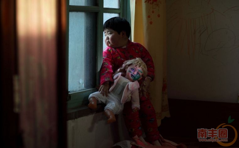 10 孙舒晴,麻疹疫苗。现智力低下，身体停止发育.jpg