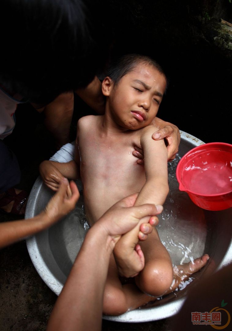 15 梁嘉怡，乙脑疫苗，重症病毒性脑炎.jpg